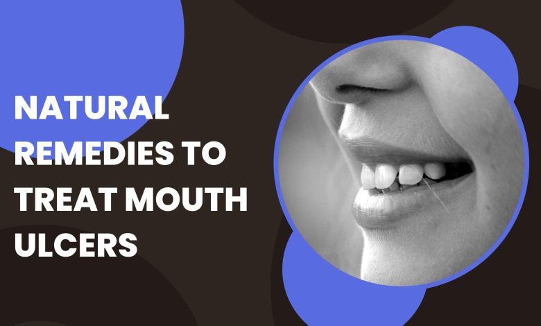 Natural Remedies to Treat Mouth Ulcers